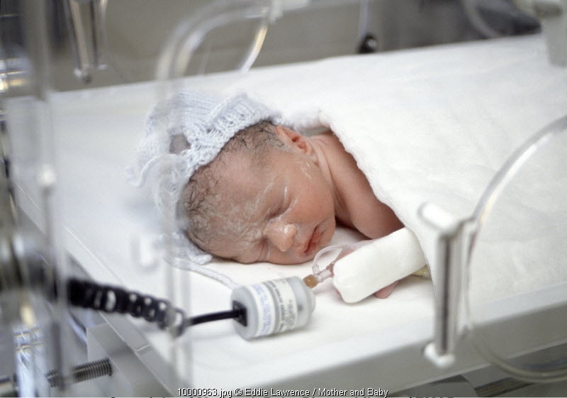 Neonatal Sepsis (2): Gejala dan Faktor Risiko