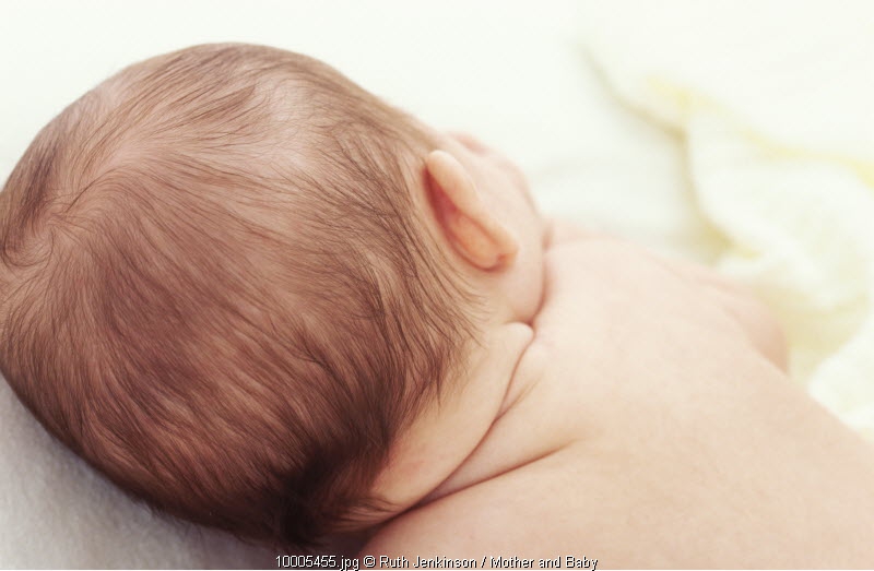 3 Tips Mengatasi Rambut Si Kecil yang Rontok