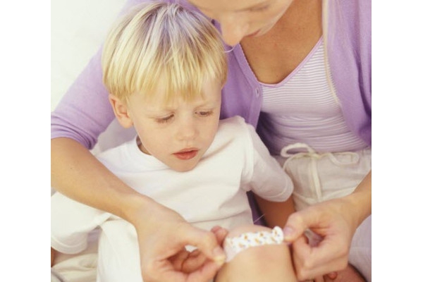 Tips Mengatasi Luka Anak saat Terjatuh