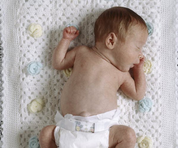 Faktor Penyebab Kelahiran Bayi Prematur