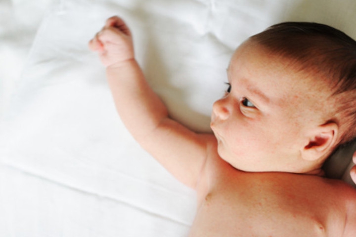 Waspada Higroma Kistik, Munculnya Benjolan di Leher Bayi