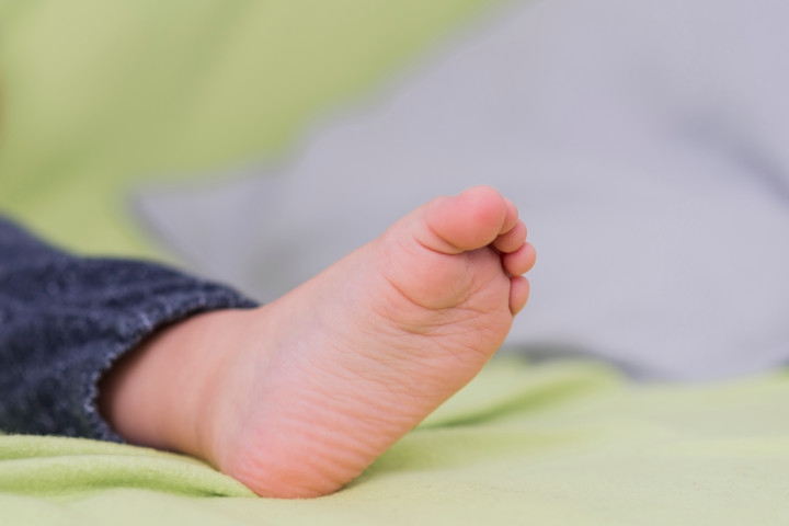 Kaki Datar pada Anak: Ciri, Penyebab dan Solusi Penanganannya