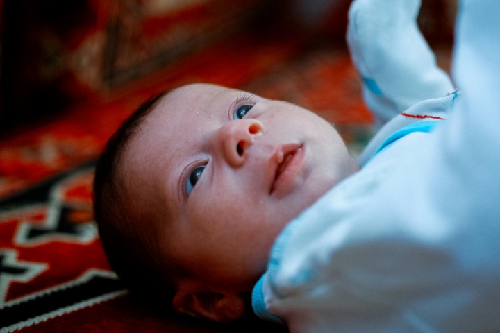 5 Cara Menghilangkan Bintik Merah pada Bayi secara Alami