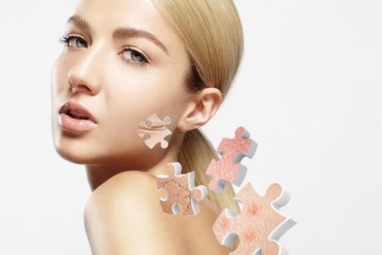 Tips Merawat dan Mengatasi Masalah Kulit Kering pada Wajah