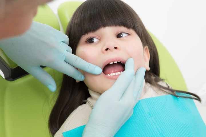 Mengatasi White Spot Gigi Anak, Bercak Putih yang Muncul Tanpa Sadar