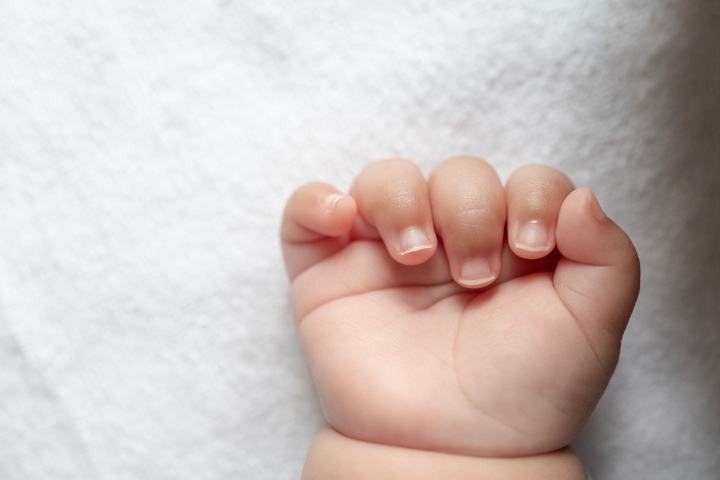 Cara Memotong Kuku Bayi yang Aman