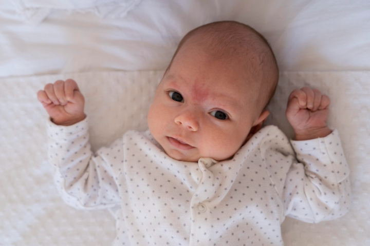 7 Rekomendasi Krim untuk Menghilangkan Bintik Merah pada Bayi
