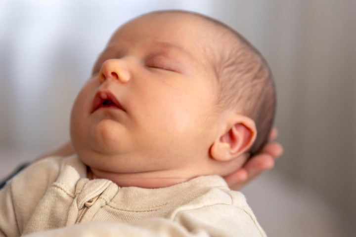 Ciri-Ciri Hidrosefalus pada Bayi yang Wajib Anda Kenali