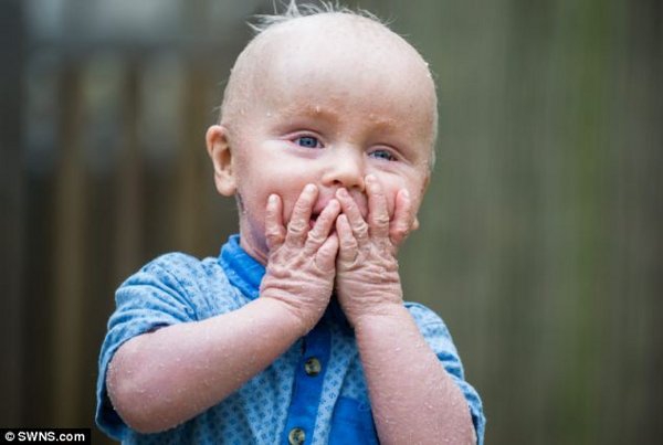 Bayi Asal Inggris Tidak Bisa Berkedip