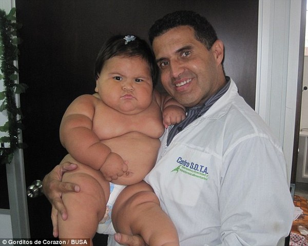 Bayi 10 Bulan Memiliki Berat Badan 20 Kg