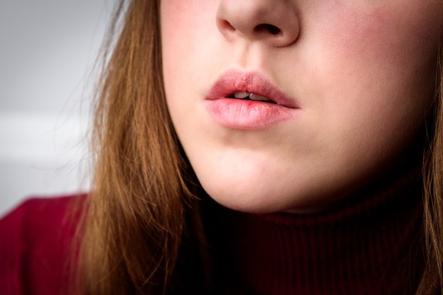 Bibir Lebih Tebal dan Gelap saat Hamil? Ini Penyebabnya, Moms