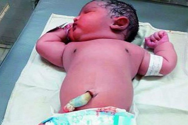 Ibu Diabetes Lahirkan Bayi 6 Kilogram