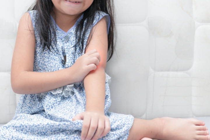 7 Penanganan Tepat saat Anak Terkena Ulat Bulu