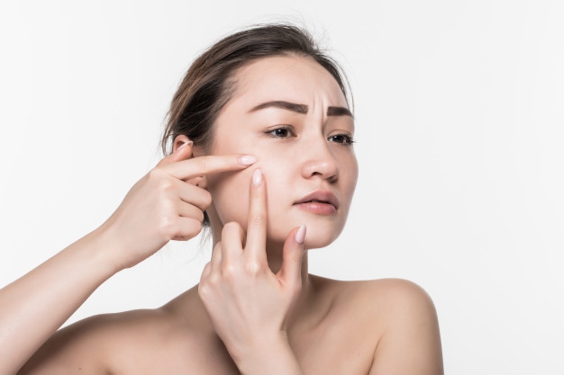 Hilangkan Jerawat dengan 5 Bahan Alami ini, Moms!