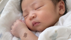 Arti Tanda Lahir Cokelat pada Bayi, Apakah Berbahaya?