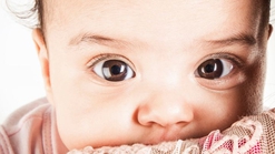 Waspada Strabismus, Kondisi Mata Juling yang Memengaruhi Penglihatan Anak