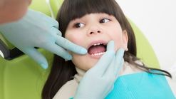 Mengatasi White Spot Gigi Anak, Bercak Putih yang Muncul Tanpa Sadar