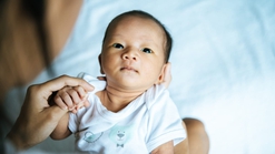 Wajib Tahu! Kadar Bilirubin Normal pada Bayi dan Tanda Bahaya yang Perlu Diwaspadai