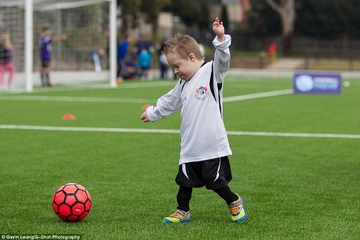 Anak Down Syndrome menjadi Anggota Tim Sepak Bola