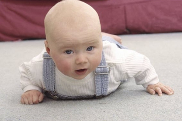 Mengenal Cerebral Palsy pada Bayi