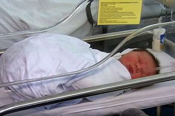 Tulang Panggul Ibu Hampir Patah saat Melahirkan Bayi Seberat 6 Kilogram