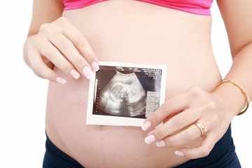 Dilema Program Bayi Tabung