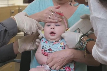 Hati-Hati, Tindik Telinga Bayi Berisiko Infeksi!