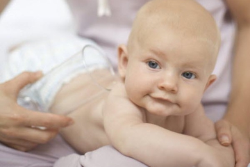 Ruam-ruam di Kulit Bayi