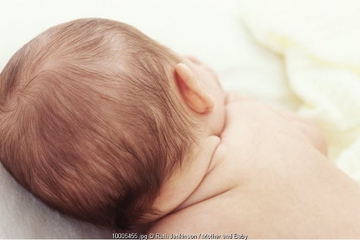 Rambut Bayi Rontok & Botak