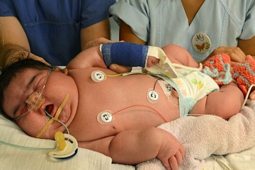 Langka, Bayi Berbobot 6 Kg Dilahirkan Normal
