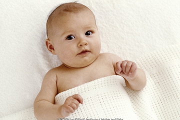 Keputihan pada Bayi