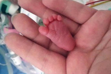 Emilia Si Bayi Termungil di Dunia