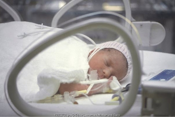 JIka Si Kecil Masuk NICU