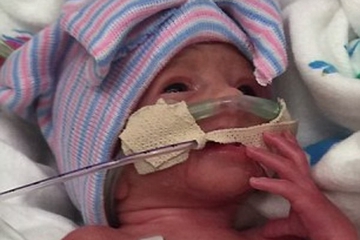 Bayi Kembar Lima Lahir di Amerika