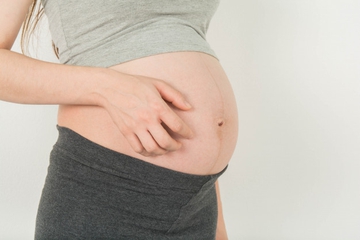 Mengenal Kolestasis, Gatal Berlebih saat Hamil