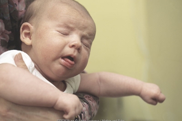 Pertolongan Jika Anak Tersedak