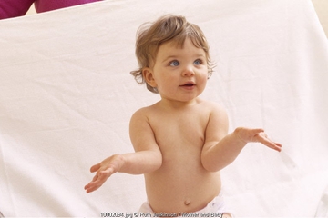 Mengapa Kulit Si Kecil Mudah Memar?