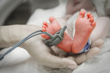 5 Faktor Bayi Lahir Prematur