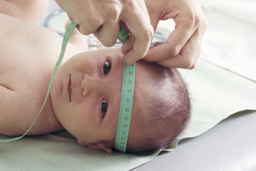Berat Badan & Lingkar Kepala Tentukan IQ Bayi