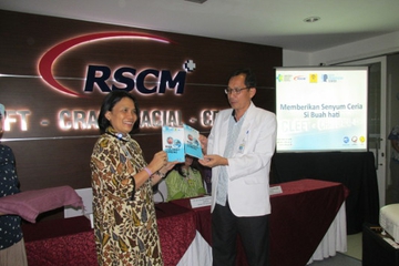 RSCM Hadirkan Fasilitas untuk Tangani Bibir Sumbing