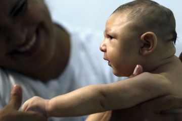 Virus Zika Sebabkan Kelainan Mata pada Bayi