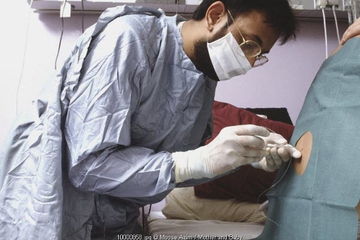 Mengenal Epidural