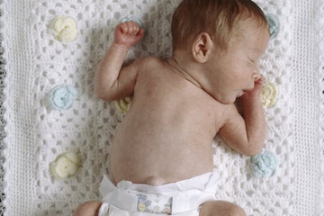 Faktor Penyebab Kelahiran Bayi Prematur