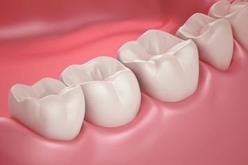 Waspadai Radang Gusi