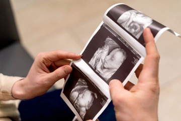 Periksakan Secara Teratur, Ini 7 Tanda Janin Sehat Trimester 1