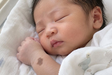 Arti Tanda Lahir Cokelat pada Bayi, Apakah Berbahaya?