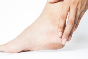 Ini Penyebab Kulit Telapak Kaki Mengelupas, Bisa Jadi Tanda Penyakit