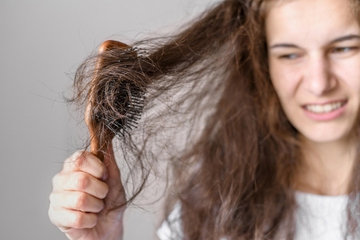 7 Cara Ampuh Mengatasi Rambut Rontok Berlebih