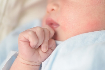 Kenali 7 Jenis Bintik Merah pada Bayi dan Cara Mencegahnya dengan Tepat