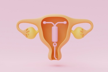 Kapan IUD Harus Diganti? Ini Penjelasannya, Moms